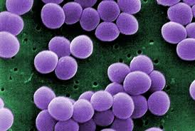 S aureus nosocomial pneumonia